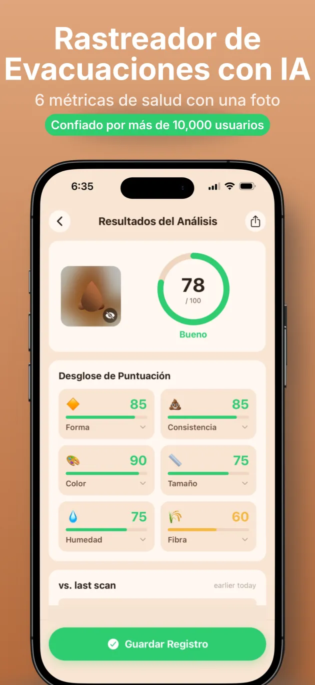 App PooIQ mostrando un análisis de heces con IA y una puntuación de salud intestinal