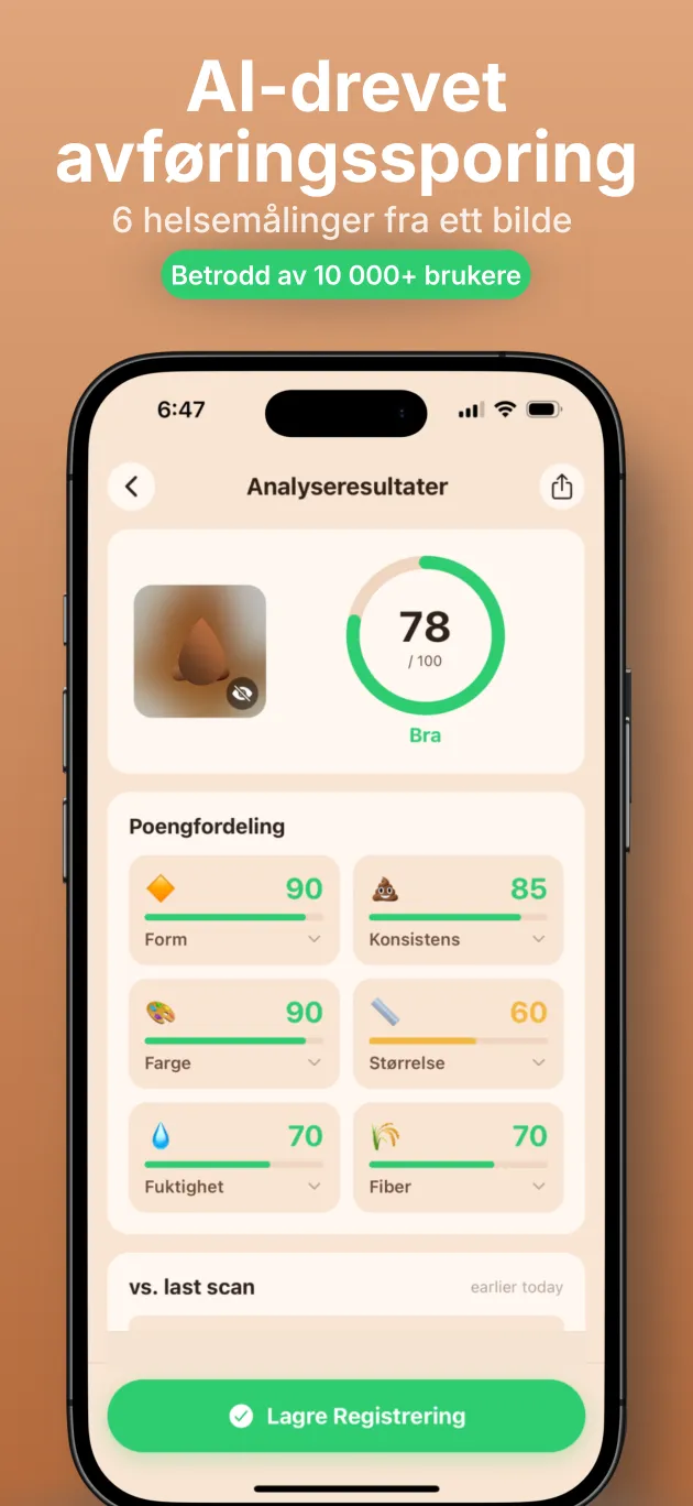 PooIQ-appen viser en AI-avføringsanalyse med tarmhelsepoeng